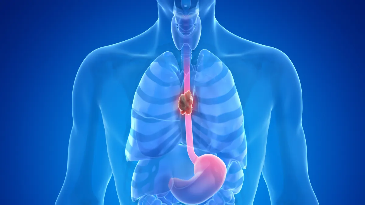 Esophageal